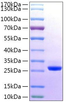 Recombinant Human BTN3A2 Protein (RPCB1422)