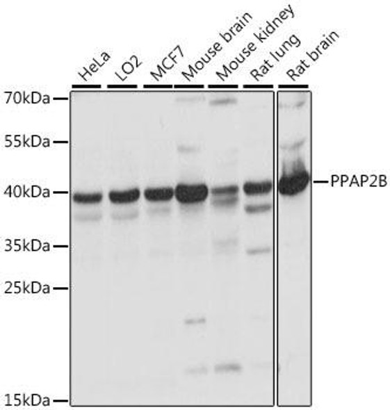 Anti-PPAP2B Antibody (CAB15743)