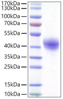 Recombinant Human DC-SIGN/CD209 Protein (RPCB1439)