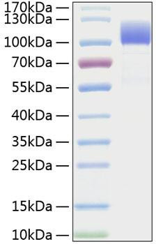 Recombinant Human CD6 Protein (RPCB1488)