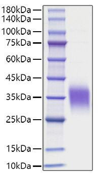 Recombinant Human IL-9 Protein (RPCB1513)