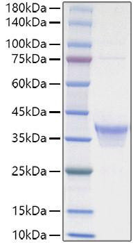 Recombinant Human IL-34 Protein (RPCB1520)