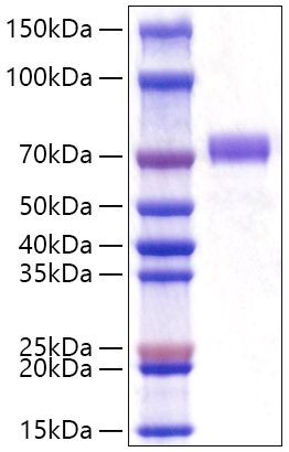 Recombinant Human GOLPH2/GOLM1 Protein (RPCB1535)