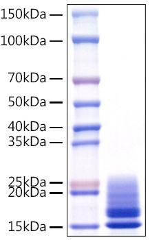 Recombinant Monkeypox virus A29 Protein (RPCB1576)
