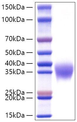 Recombinant Mouse Fc gamma RIIB/FCGR2B/CD32b Protein (RPCB1577)