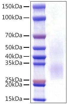 Recombinant Rat PD-1/PDCD1/CD279 Protein (RPCB1578)