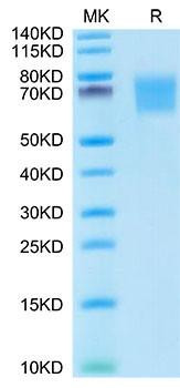 Recombinant Human FGFR-2 alpha (IIIb)/KGFR/CD332 Protein (RPCB1600)