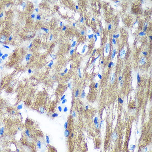 Anti-TIMMDC1 Antibody (CAB15839)