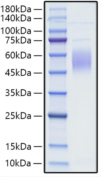 Recombinant Human CRTAM/CD355 (A65V) Protein (RPCB1664)