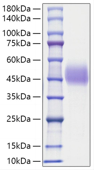 Recombinant Human C1QC Protein (RPCB1669)
