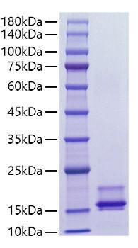 Recombinant Human CCL2/MCP-1 Protein (RPCB1681)