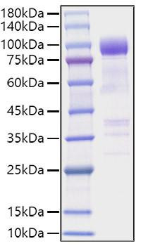 Recombinant Mouse IL1RL1/ST2 Protein (RPCB1706)
