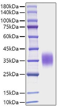 Recombinant Mouse IL-9 Protein (RPCB1716)