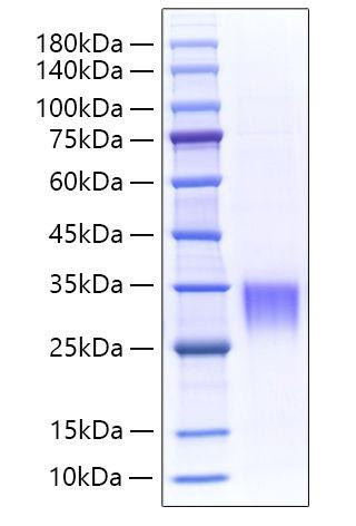 Recombinant Mouse Asprosin/Fibrillin-1/FBN1 Protein (RPCB1729)