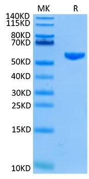 Recombinant Human GP100 (HLA-A*02:01) Complex Protein (RPCB1736)