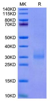 Recombinant Cynomolgus NKG2A&KLRD1/CD159a&CD94 Protein (RPCB1739)