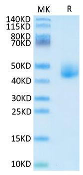 Recombinant Human DLK1 Protein (RPCB1746)