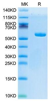 Recombinant Human AFP (HLA-A*02:01) Complex Protein (RPCB1754)