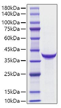 Recombinant Human PG IIï¼ˆPGCï¼‰ Protein (RPCB1766)