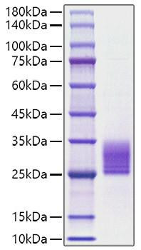 Recombinant Rat IL-6 Protein (RPCB1768)