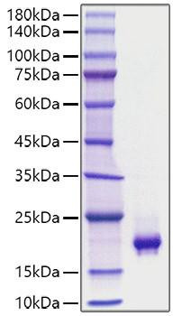 Recombinant Mouse PDGF-BB Protein (RPCB1776)