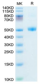 Recombinant Mouse FSH Beta Protein (RPCB1807)
