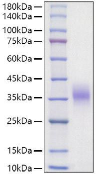 Recombinant Mouse Erythropoietin/EPO Protein (RPCB1810)