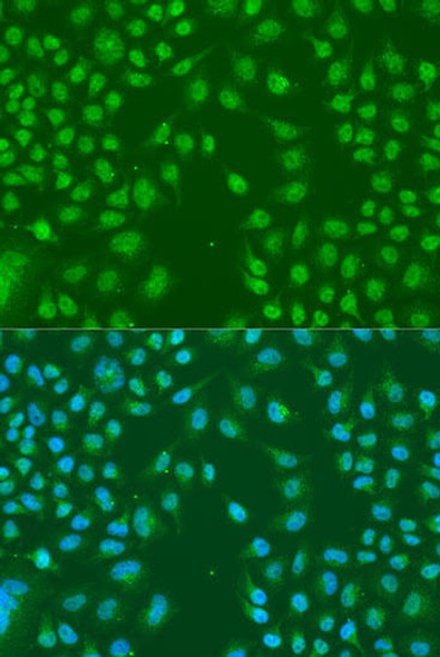 Anti-HNRNPCL1 Antibody (CAB16011)