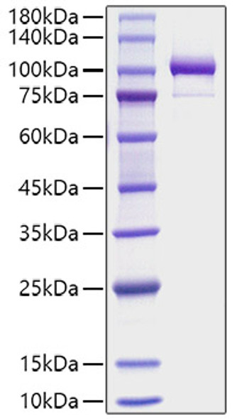 Recombinant Human Periostin/PN/POSTN Protein (RPCB1813)