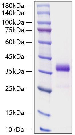 Recombinant Human IGFBP-7 Protein (RPCB1816)