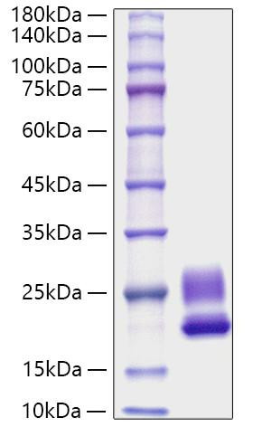 Recombinant Rat IL-21 Protein (RPCB1827)