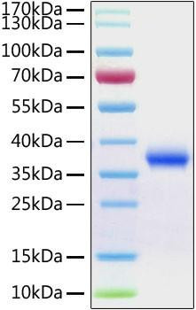 Recombinant Human Aldehyde reductase/AKR1B1 Protein (RPCB1858)