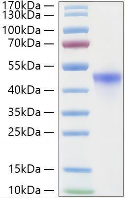 Recombinant Human RRM2 Protein (RPCB1863)