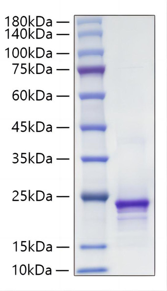 Recombinant Mouse FGF-10 Protein (RPCB1866)