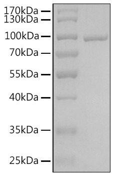 Recombinant Human Argonaute-3/AGO3 Protein (RPCB1870)