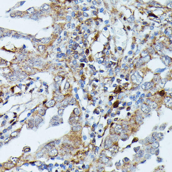 Anti-MAP3K3 Antibody (CAB16058)