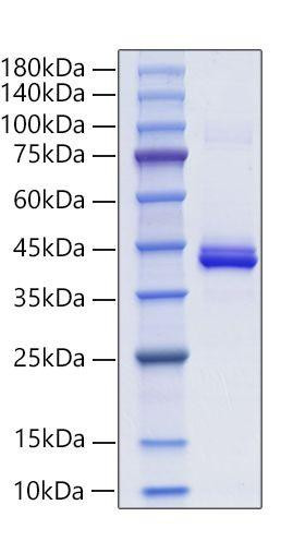 Recombinant Mouse CXCL4/PF-4 Protein (RPCB1884)