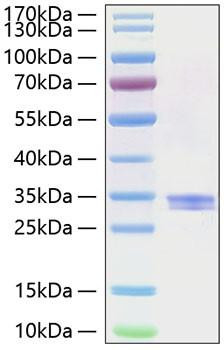 Recombinant Human IFI30 Protein (RPCB1895)