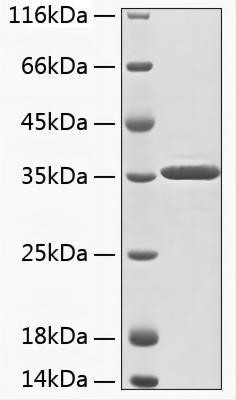 Recombinant Human Aminoacylase-3/ACY 3 Protein (RPCB1928)