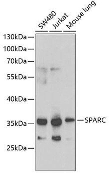 Anti-SPARC Antibody (CAB1615)