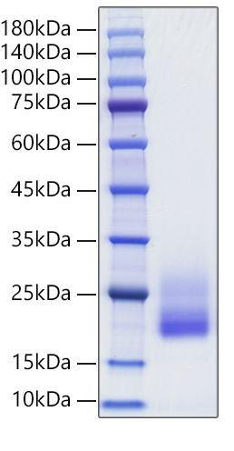 Recombinant Rat IL-4 Protein (RPCB2008)