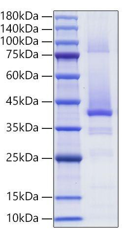 Recombinant Human IGF-II Protein (RPCB2009)