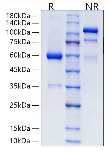 Recombinant Human R-spondin-2/RSPO2 Protein (RPCB2027)