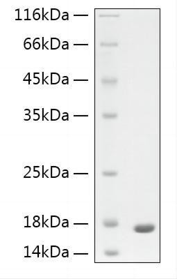 Recombinant Human GFAP protein (RPCB2028)