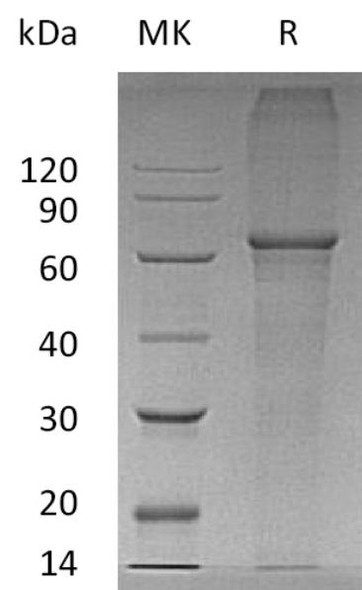 Recombinant Human XPNPEP3 Protein (RPCB2037)