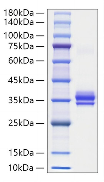 Recombinant Mouse IgG1 Protein (RPCB2061)