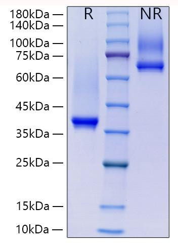 Recombinant Human IgG1 Protein (RPCB2072)