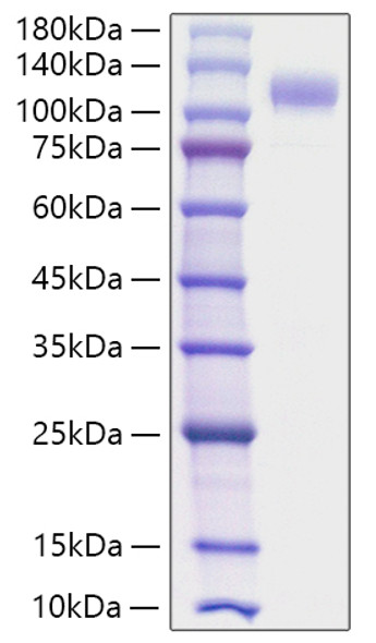 Recombinant Human Siglec-10 Protein (RPCB2077)