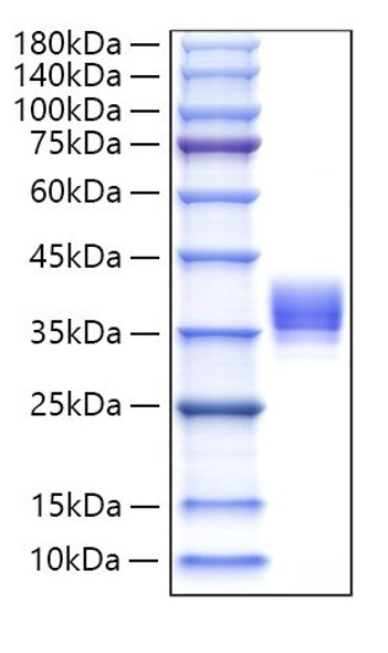 Recombinant Human IgM Protein (RPCB2082)