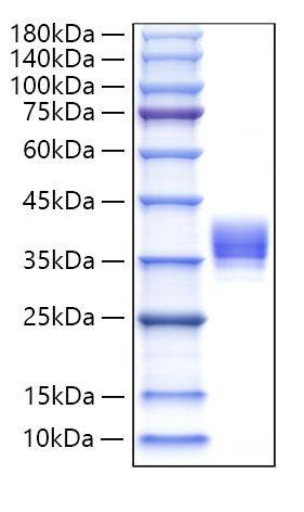 Recombinant Human IgM Protein (RPCB2082)